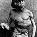 220px-josephmerrick1889